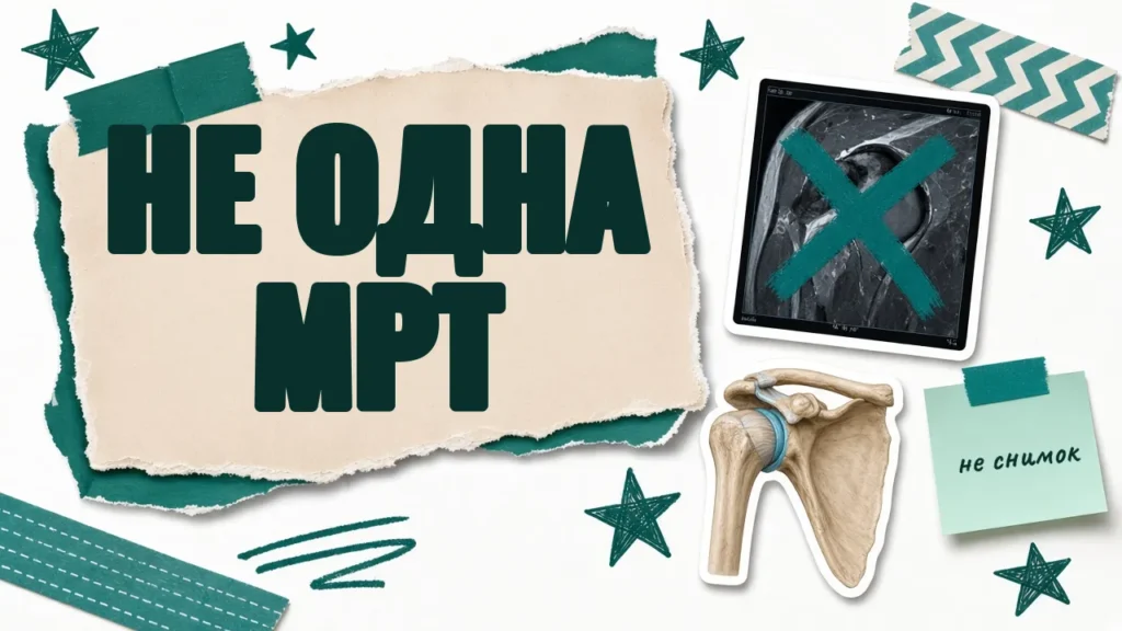Замороженное плечо: когда рука не поднимается ни сама, ни с помощью